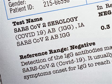 how to get a hard copy of covid test results|At.